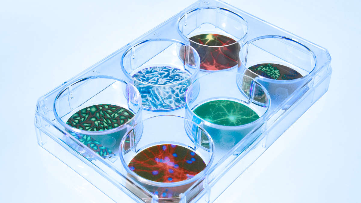 Transfection Plate with different cell cultures